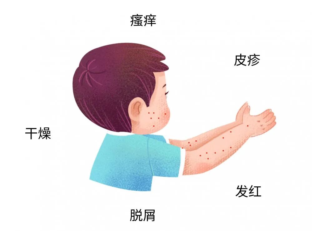 这些症状都可能是宝宝过敏传递的信号，，，很多宝妈还不知道